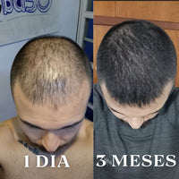 Minoxidil 12% Original + Aceite 4 en 1 GRATIS!